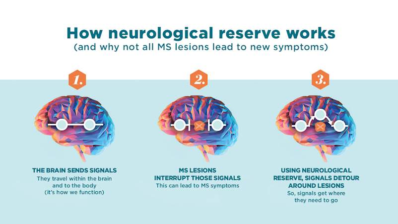 INFOGRAPHIC: Neurological Reserve/how the brain can “re-wire” itself