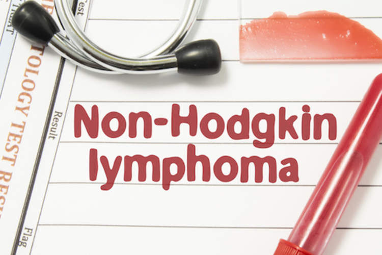 Diagnosis of Non-Hodgkin lymphoma. Laboratory blood bottle, glass slide with blood smear, hematology test, stethoscope lying on note with printed text hematological diagnosis of Non Hodgkin lymphoma.