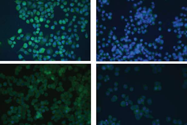 Modulation of the BRCA1 Protein and Induction of Apoptosis in Triple Negative Breast Cancer Cell Lines by the Polyphenolic Compound Curcumin