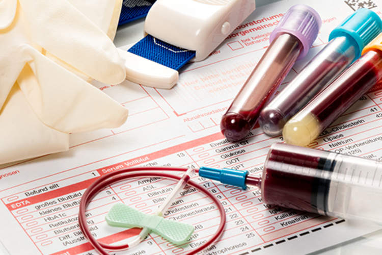 Blood vials and results of a blood test.