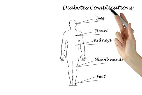 Diabetes complications