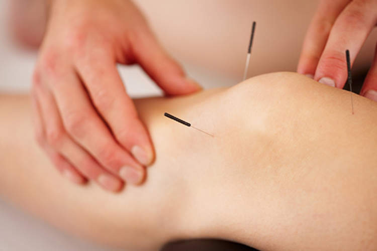 Acupuncture treatment in the leg