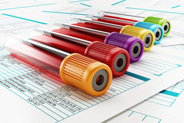 Blood test tubes.