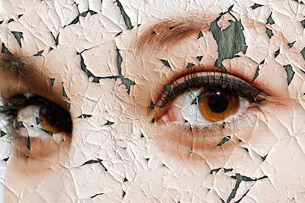Cracked skin, skin disorder concept, sad eyes.