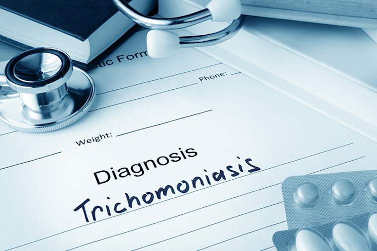 Trichomoniasis diagnosis, STD.