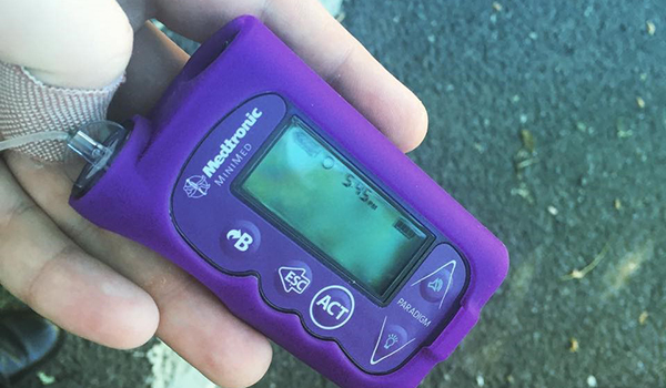 insulin pump