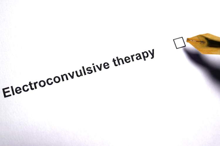 Checking off Electroconvulsive Therapy