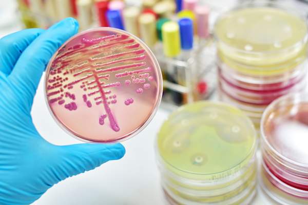 Bacteria cultures