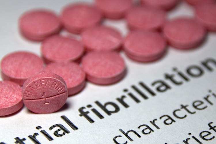 AFib Patients Not Getting Stroke-Preventing Meds