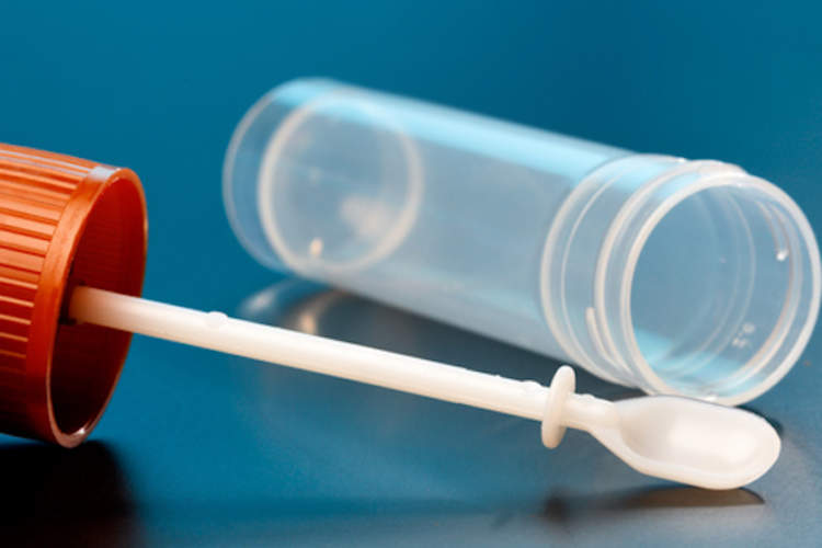 Stool sample vial