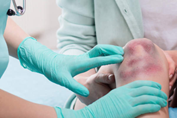doctor checking bruises