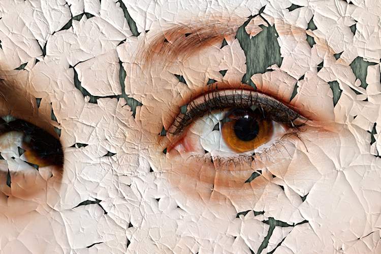Close up of sad eyes with cracked skin concept.