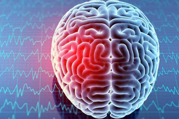 Brain injury and MRI results.