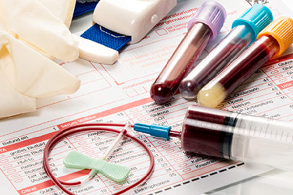 Blood samples for a blood test.