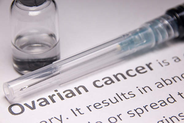 Ovarian cancer.