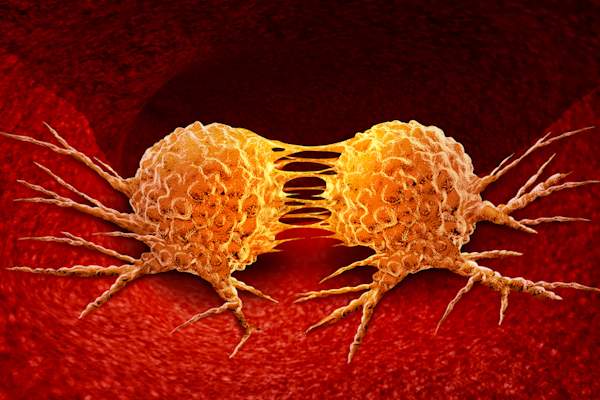 Dividing cancer cells.