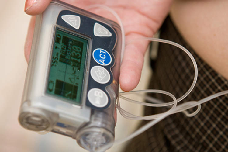 insulin pump image