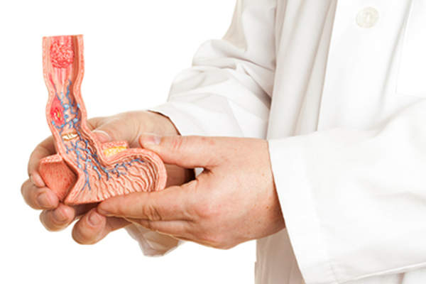 Doctor holding a model of the esophagus.