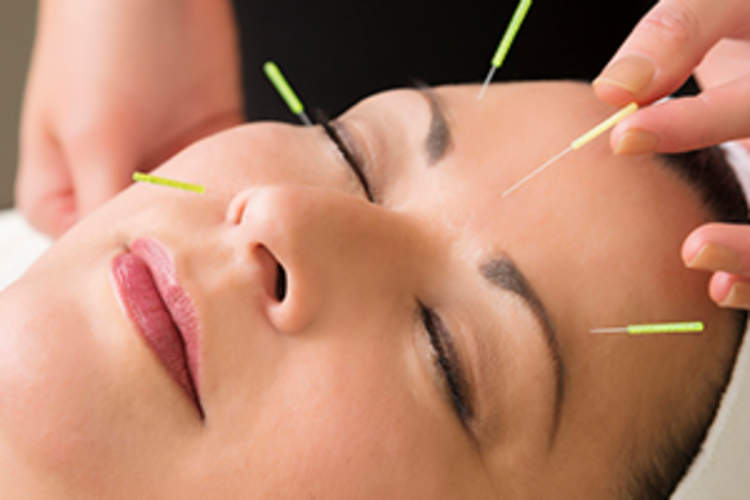 Mature woman getting acupuncture treatment at the spa