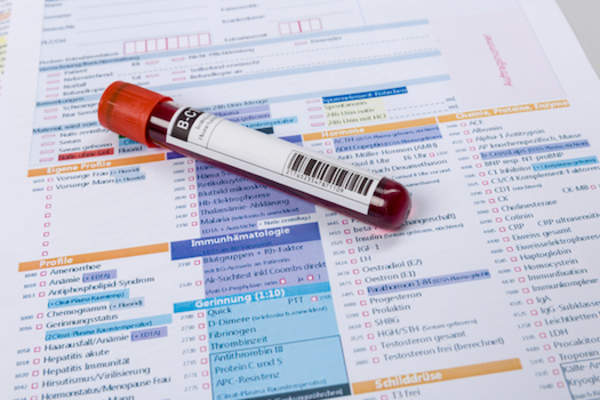 Blood test check RA remission.