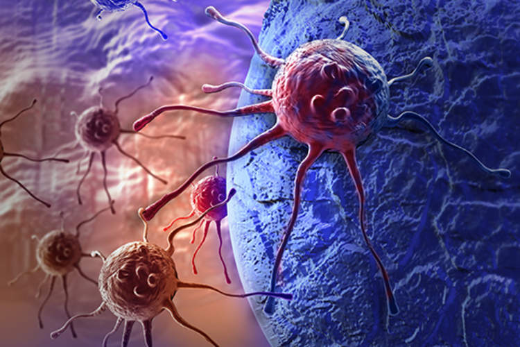 Cancer cells