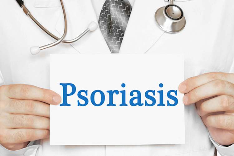 Doctor holding "Psoriasis"