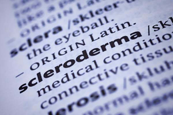 Scleroderma definition