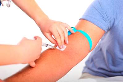How to Manage Hepatitis C