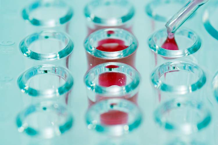 What to Know About Hepatitis C