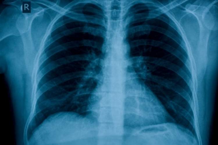 Radiation From Tests