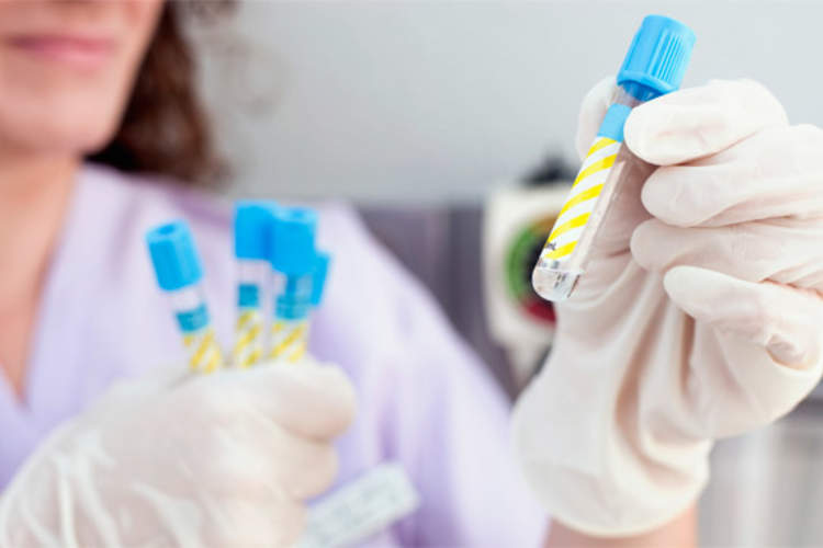 What You Need to Know About Diagnostic Tests