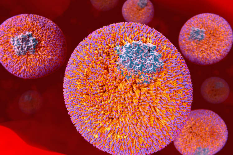 Reduce LDLs to Slash Heart Disease Risk