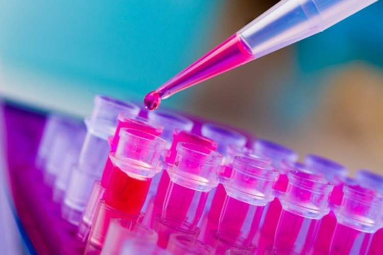 Multiple Myeloma Causes