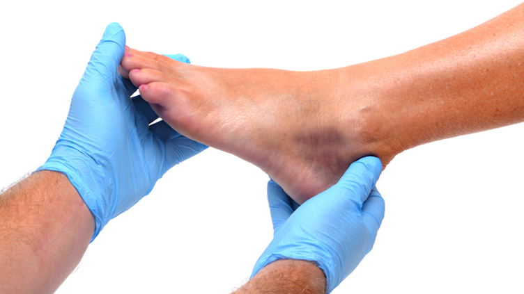 Doctor examining foot.