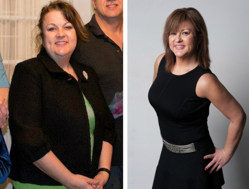 my bariatric life, joseph f. cappella m.d.