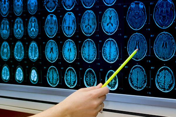 Brain scan.