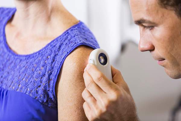 Follow up check with dermatologist.