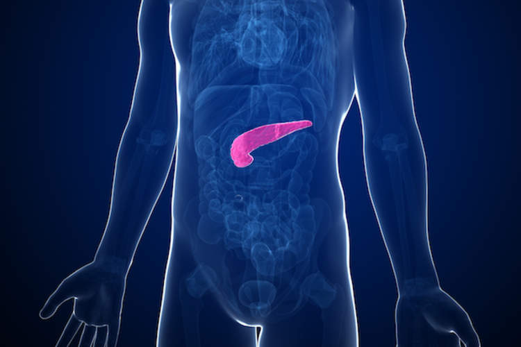 Pancreatitis