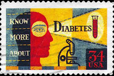 Diabetes history.