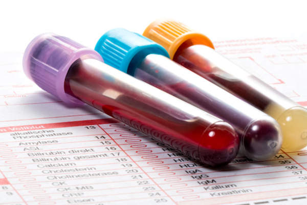 Blood test, blood samples on a laboratory form