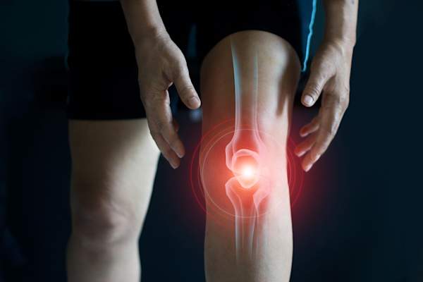 knee osteoarthritis