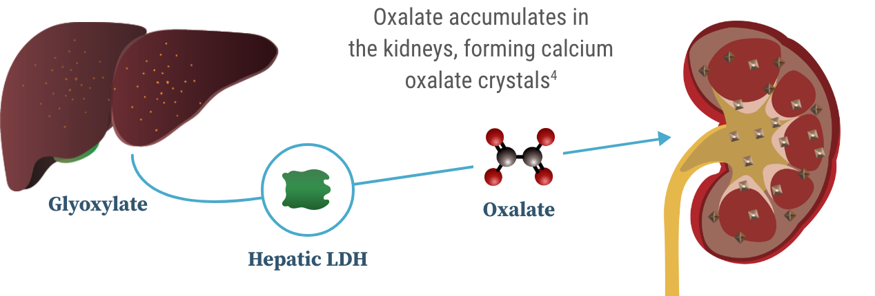 Graphic showing that hepatic LDH converts glyoxylate to oxalate, which then travels from the liver to the kidneys. Graphic showing that hepatic LDH converts glyoxylate to oxalate, which then travels from the liver to the kidneys.