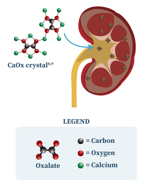 Graphic showing that calcium oxalate crystals combine to form kidney stones in people with primary hyperoxaluria. Graphic showing that calcium oxalate crystals combine to form kidney stones in people with primary hyperoxaluria.