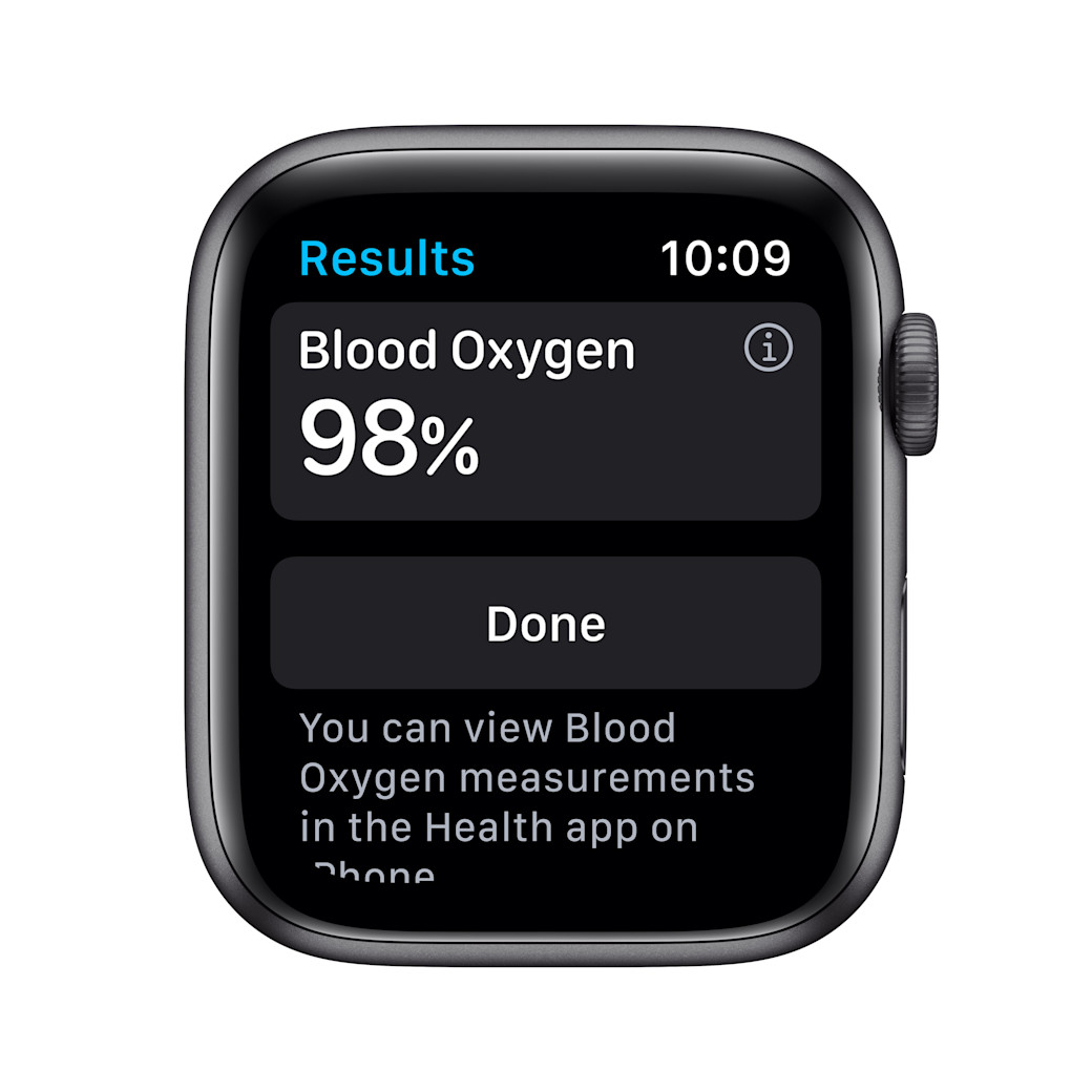 Apple Watch 6 Anzeige Sauerstoffgehalt im Blut