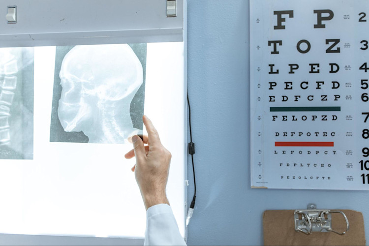 An X-ray being examined.