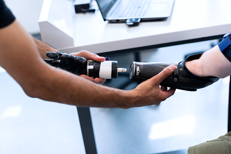 A person with a prosthetic arm that is classified as an orthotic device.