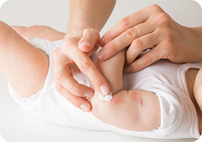 How to Spot and Soothe Eczema in Babies