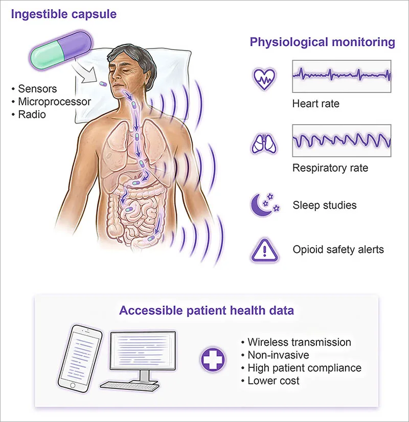 Graphical abstract in Device journal: The Vitals Monitoring Pill is ingested and provides real time vital sign data (Credit: Virginia E Fulford Alar Illustration)