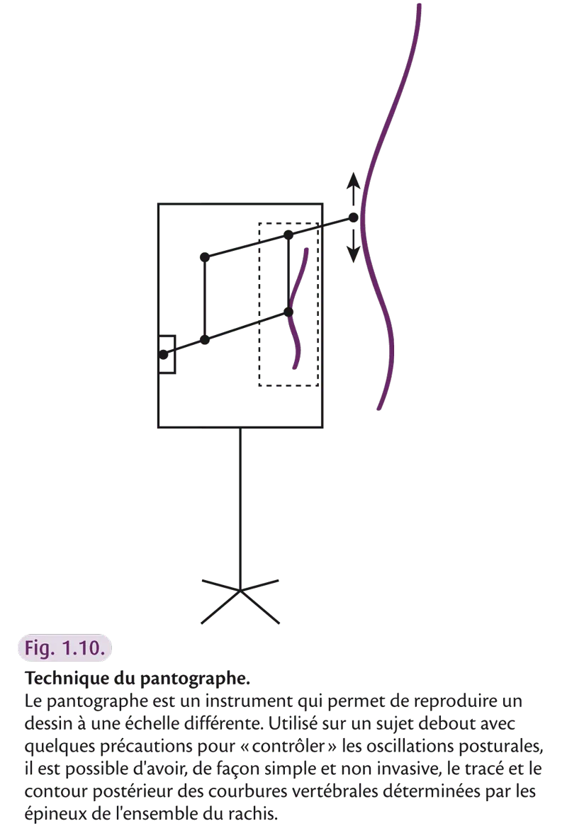 Fig 1.10