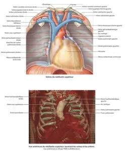 Médiastin supérieur - veines et artères